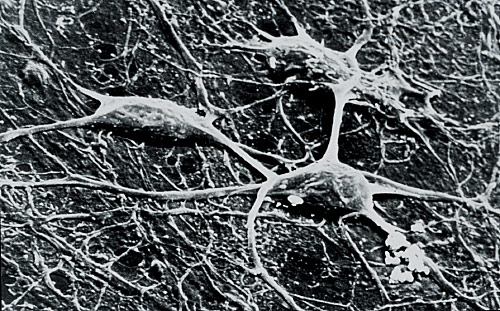 Véronique Joumard, Neurones, 1990